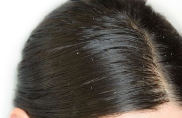 tips khắc phục tóc bết mùa hè 1