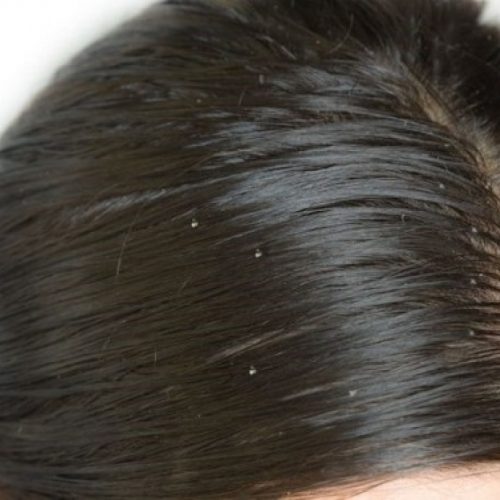 tips khắc phục tóc bết mùa hè 1