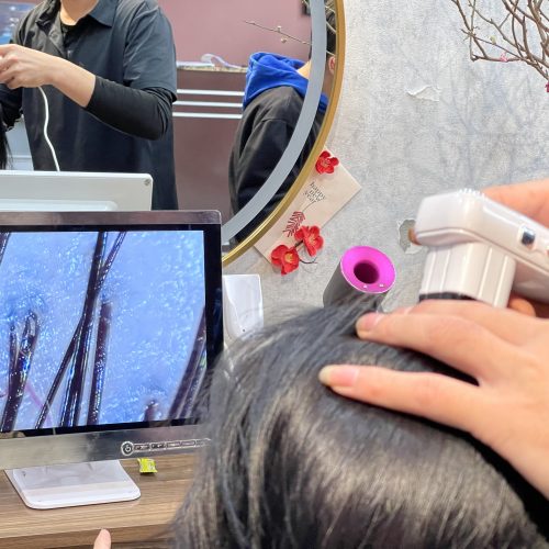 thanh tẩy da đầu khi giao mùa đông - xuân