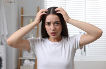 Nguyên nhân ngứa da đầu sau khi đi du lịch