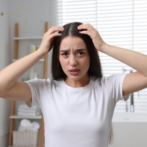Nguyên nhân ngứa da đầu sau khi đi du lịch
