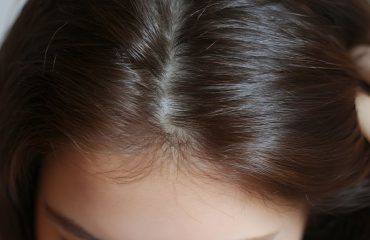 da đầu khoẻ là gì