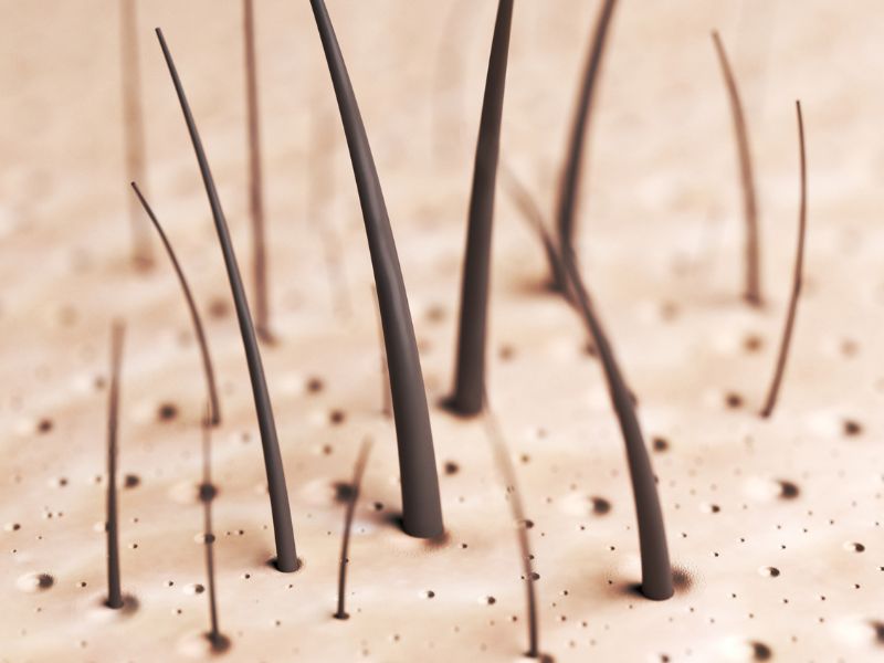 vì sao tóc dễ rụng dù đã phục hồi