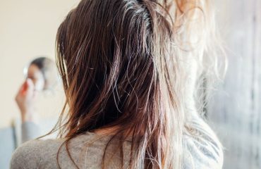 da đầu dầu nhưng vẫn khô ngứa