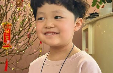 da đầu bé nhạy cảm