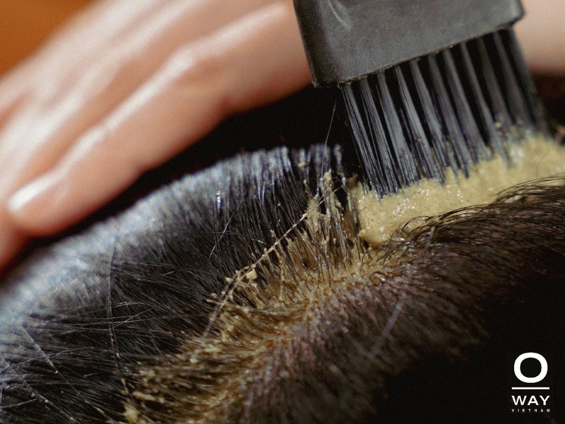 da đầu nhạy cảm