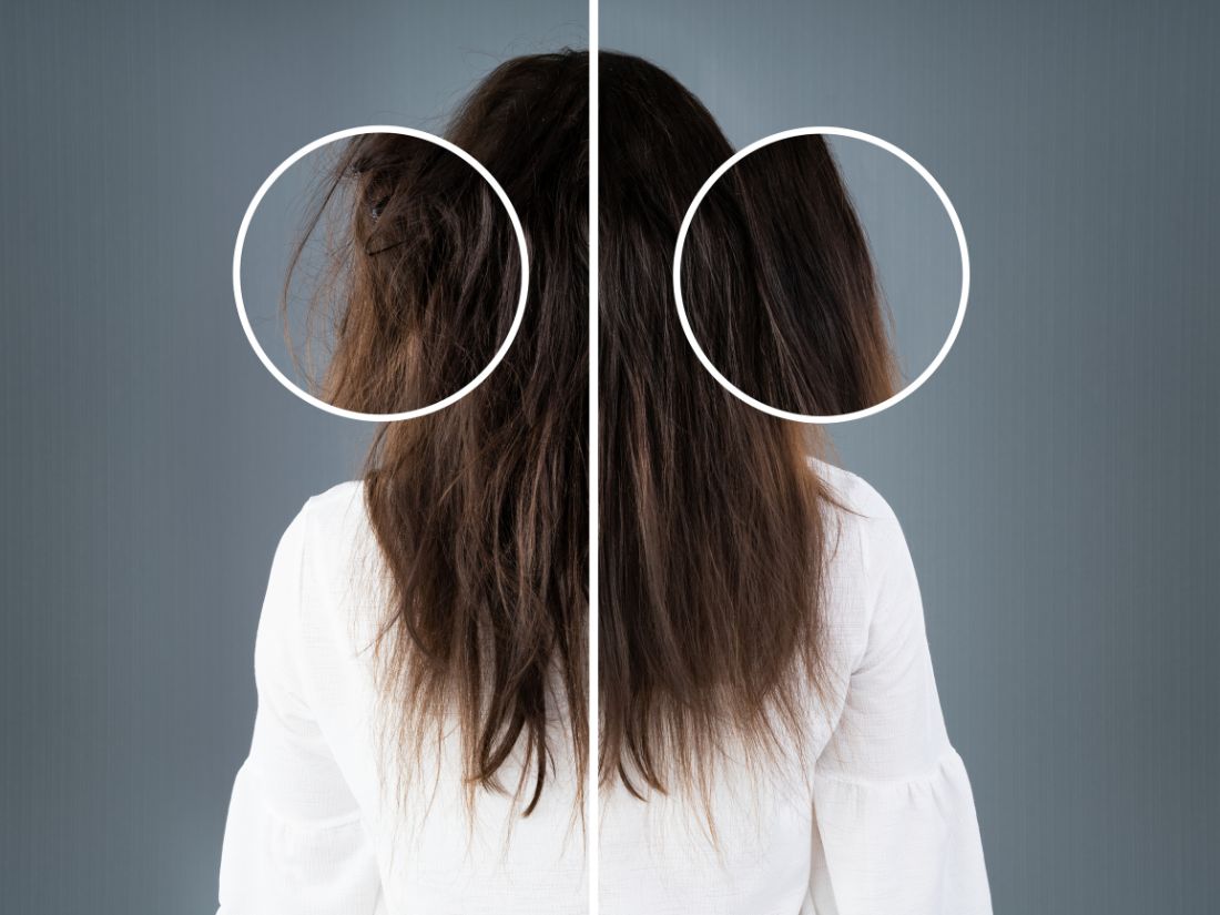 phục hồi tóc không silicon