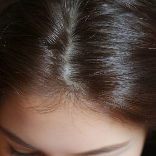 da đầu khoẻ là gì