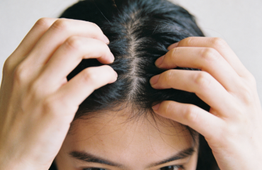 Thanh tẩy da đầu cho da nhạy cảm