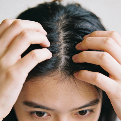 Thanh tẩy da đầu cho da nhạy cảm