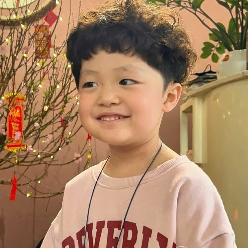 da đầu bé nhạy cảm